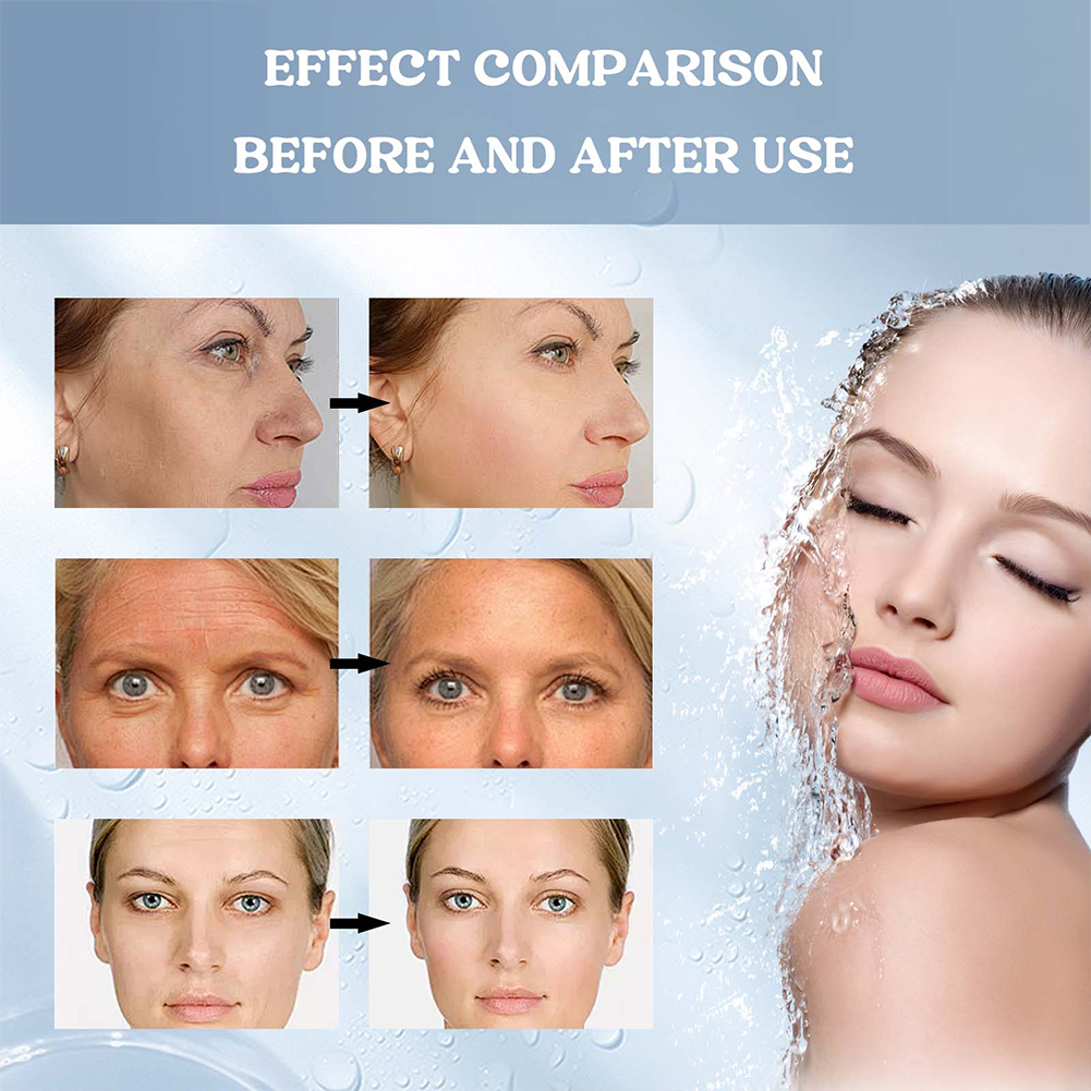 Bio-Collagen Real Deep Mask So - đánh giá và giá Sheet Mask Collagen